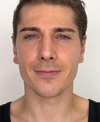 Ivo